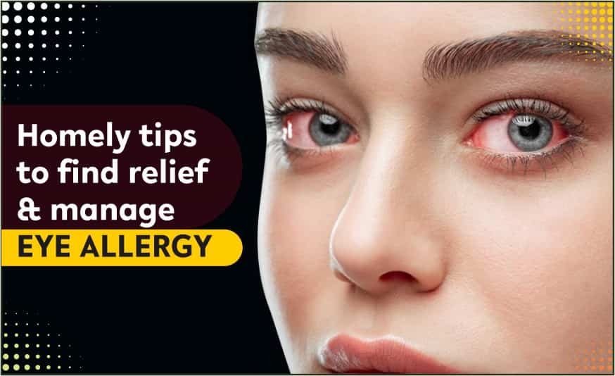 Natural Remedies for Eye Allergies
